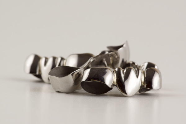 歯科 銀歯 銀 詰め物 被せ物 パラジウム 金属 金パラ 